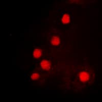 HOXC6 Antibody (C-Terminus)