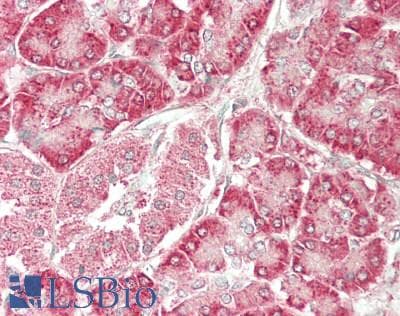 IHC-plus™ PSAT1 Antibody