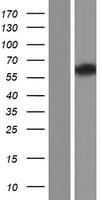 Human SPAM1 / PH20 Protein (Over-Expression Lysate Myc-DDK (Flag))