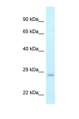 Polyclonal Rabbit anti-Human GADD45GIP1 / CRIF1 Antibody (aa102-151, WB)