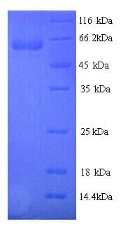 Human PGLYRP2 Protein (Recombinant 6His, N-terminus)