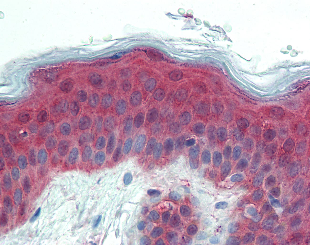 IHC-plus™ ITGA3 / CD49c Antibody (Internal)