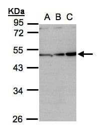 INHBA / Inhibin Beta A Antibody (aa362-426)