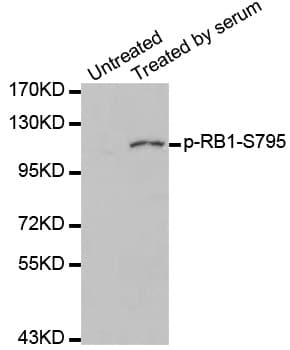 RB1 / Retinoblastoma / RB Antibody (phospho-Ser795)