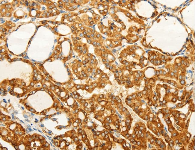 FZD6 / Frizzled 6 Antibody