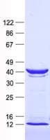 Human CSNK2A1 Protein (Recombinant His, N-Terminal)