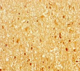 AHR Antibody