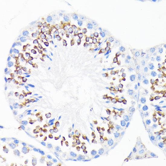 LL37 / Cathelicidin Antibody