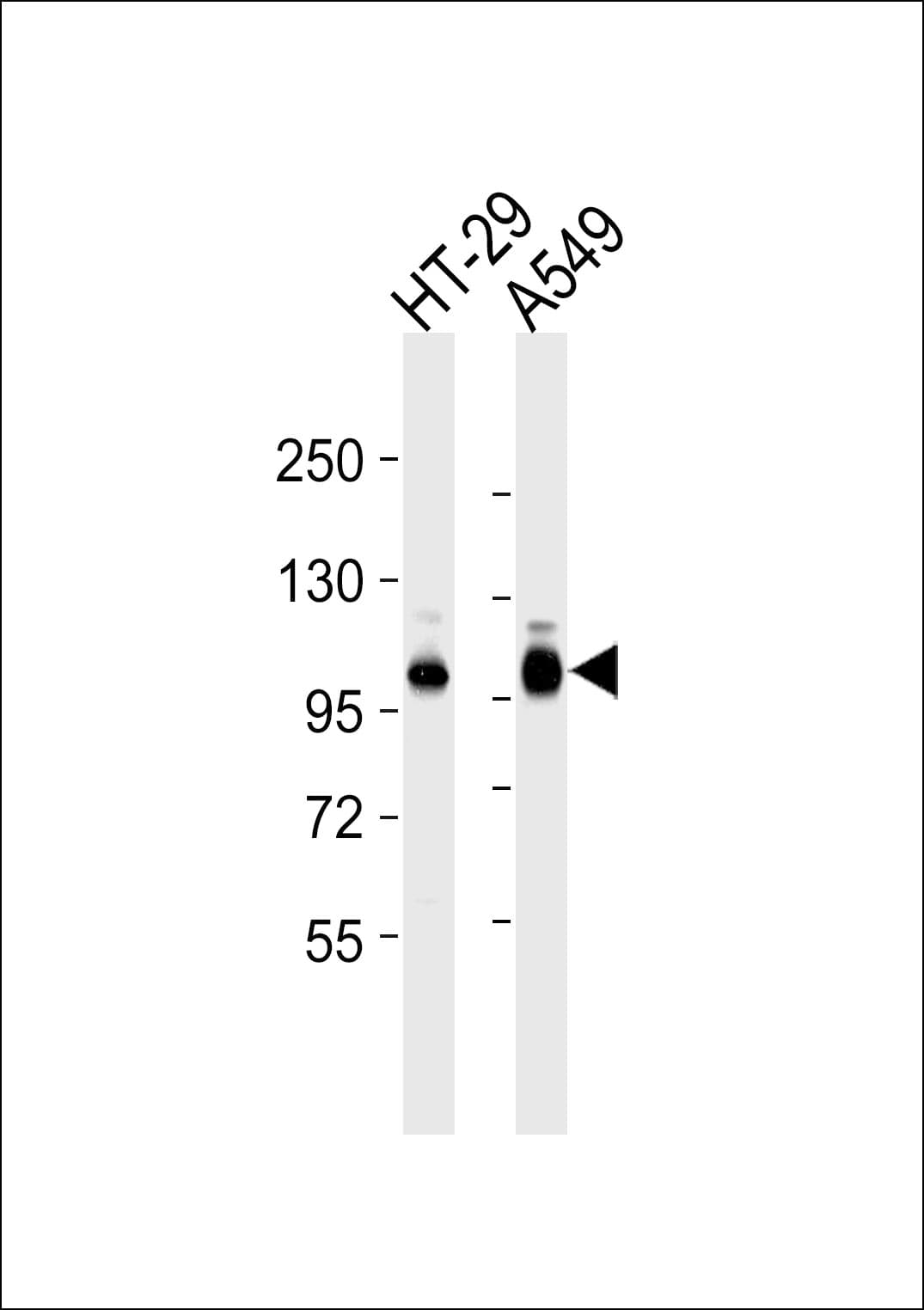 ITGB5 / Integrin Beta 5 Antibody