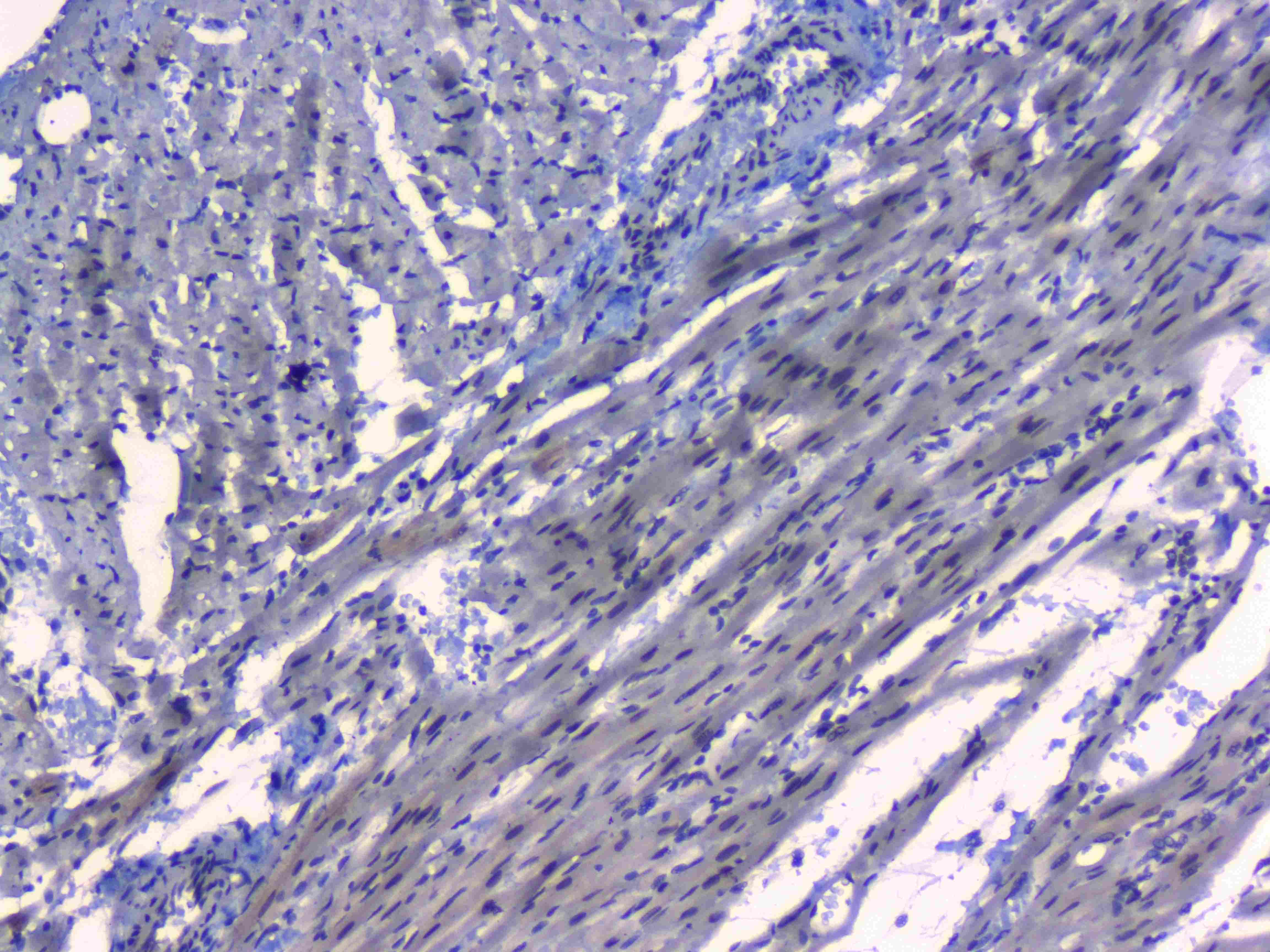 MAX Antibody