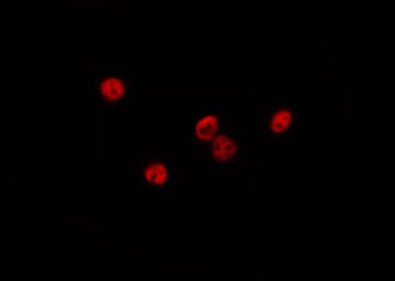 Polyclonal Rabbit anti-Human DQX1 Antibody (IF, WB)