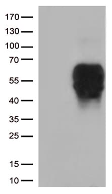 BTLA / CD272 Antibody (aa31-157+Mouse, clone OTI9A10)