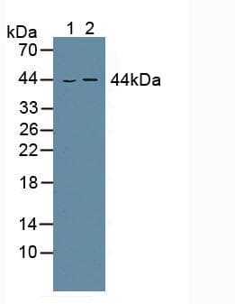 Aspartate Aminotransferase Antibody (aa1-413)