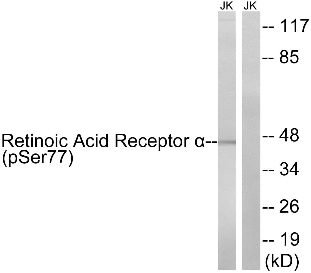 RARA / RAR Alpha Antibody (phospho-Ser77)