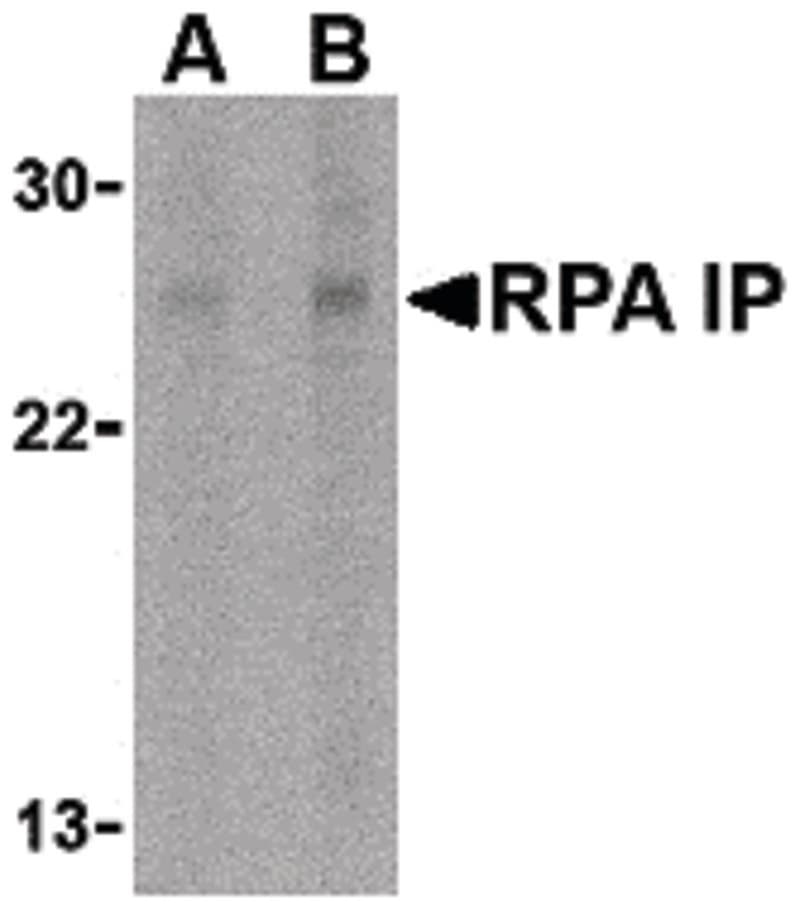 IHC-plus™ Polyclonal Rabbit anti-Human RPAIN Antibody (IHC, WB)