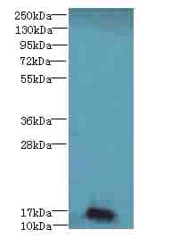 Polyclonal Rabbit anti-Human NR2C2AP / TRA16 Antibody (IHC, WB)
