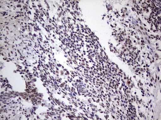 LPIN1 / Lipin 1 Antibody (clone OTI1B7)