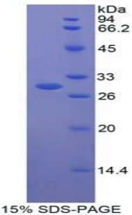 Human CNTFR Protein (Recombinant His-T7)