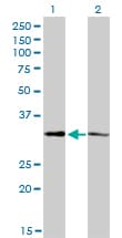 MED27 / CRSP8 Antibody (clone 8B8)