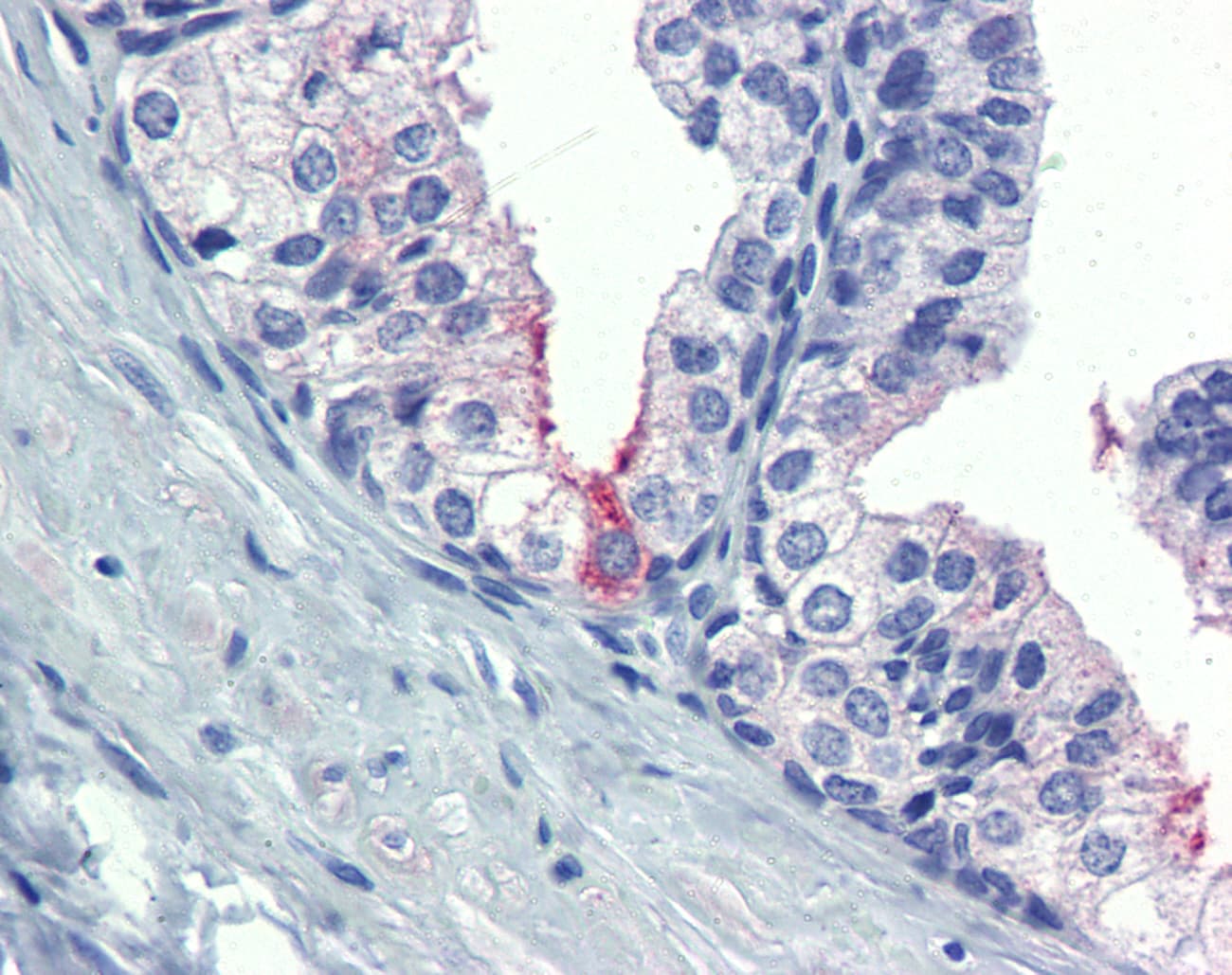 AMH / Anti-Mullerian Hormone Antibody (aa468-517)