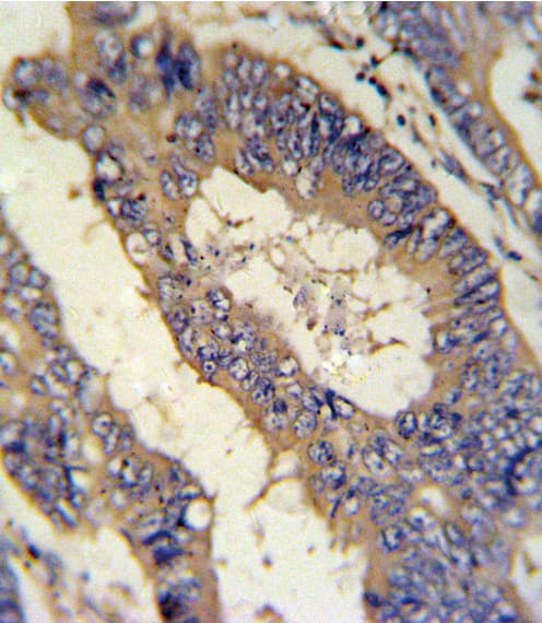 EREG / Epiregulin Antibody (aa137-165)