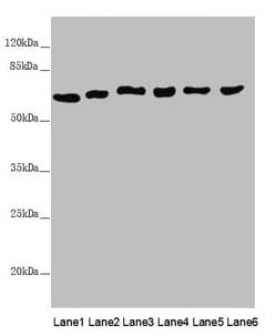 MCCC2 / MCCB Antibody