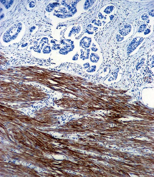 ACTA1 / Skeletal Muscle Actin Antibody