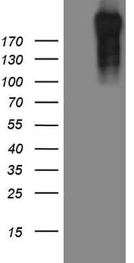 Monoclonal Mouse anti-Human POLR2A / RNA polymerase II Antibody (clone OTI3C8, aa1351-1614, IHC, WB)