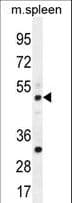 Polyclonal Rabbit anti-Human TBC1D13 Antibody (aa76-105, IHC, IF, WB)