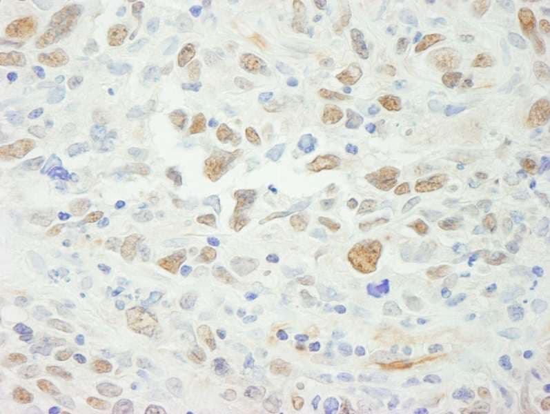 MSH6 Antibody (aa350-400)