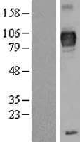 Human TYRP1 / gp75 Protein (Over-Expression Lysate Myc-DDK (Flag))