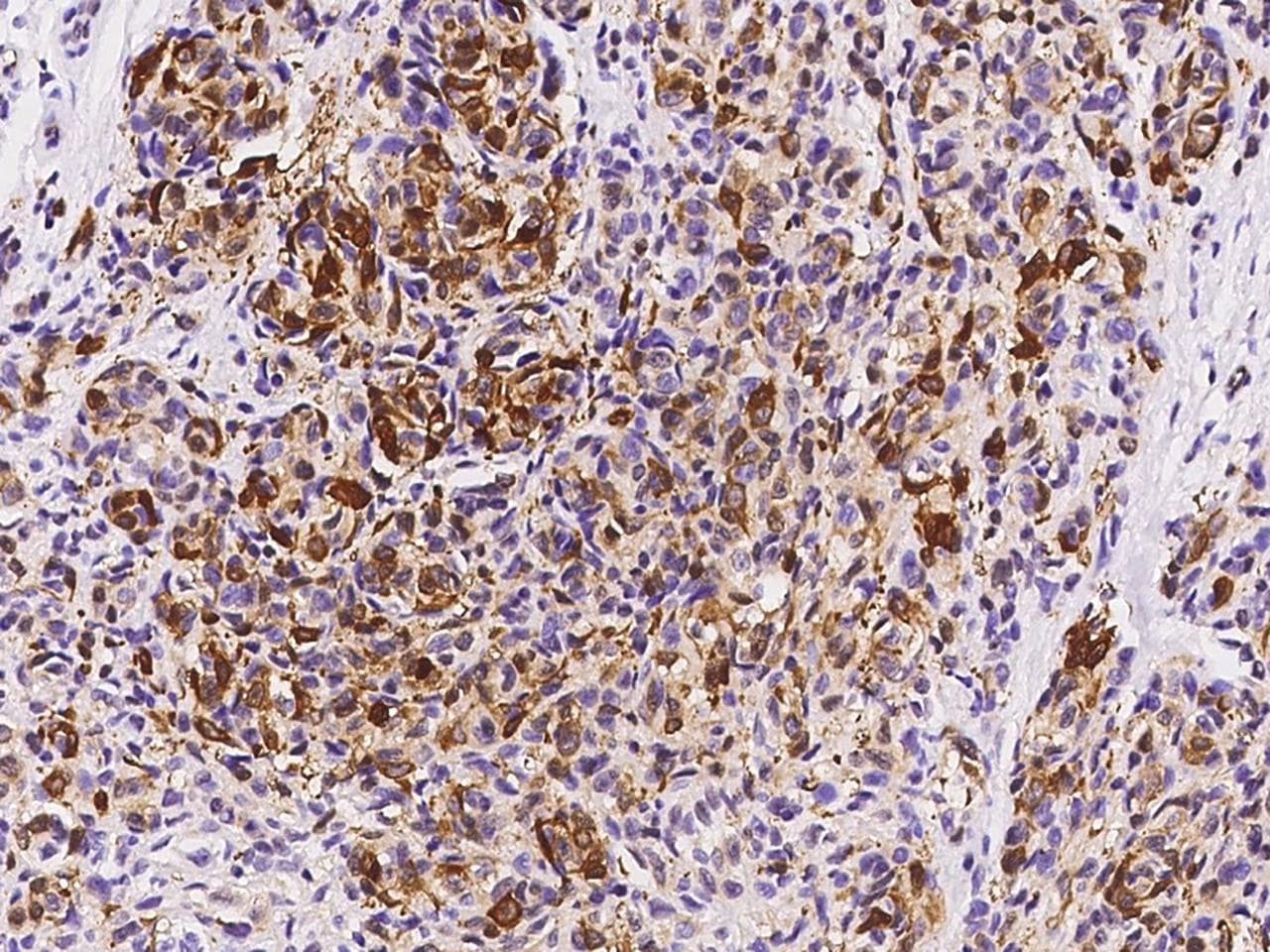FABP7 / BLBP / MRG Antibody (Preservative Free)