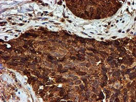 PSMB9 Antibody (clone OTI2B6)