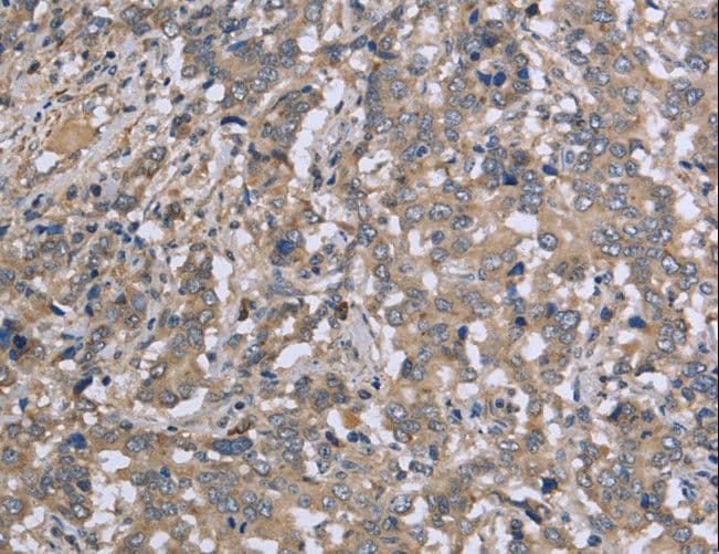 DTNB / Dystrobrevin Beta Antibody