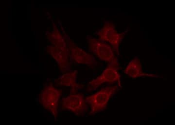 AGPAT3 Antibody
