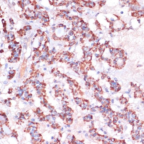 MRPL23 Antibody