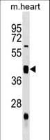 UHMK1 / KIS Antibody (aa1-30)