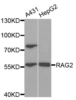 Polyclonal Rabbit anti-Human RAG2 / RAG-2 Antibody (WB)