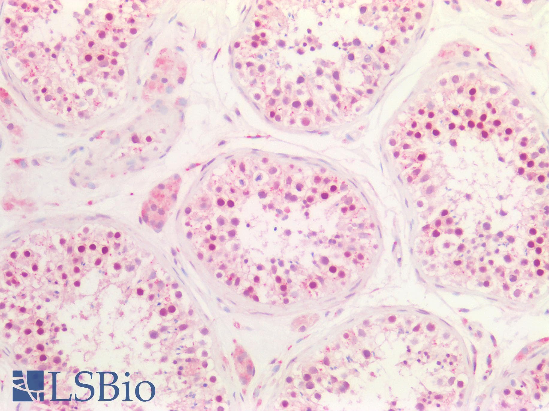 PathPlus™ MEN1 / Menin Antibody (aa575-C-term)