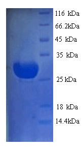 Bryonia dioica Bryodin I Protein (Recombinant His)