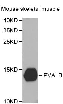 Polyclonal Rabbit anti-Human PVALB / Parvalbumin Antibody (IHC, WB)