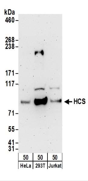 HLCS / HCS Antibody (aa1-50)
