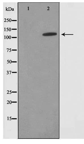 Polyclonal Rabbit anti-Human SUPT16H / FACTP140 Antibody (WB)