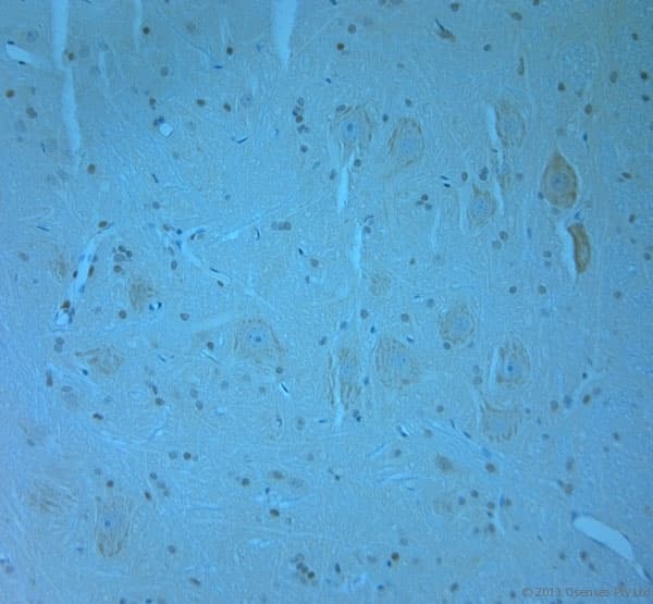 WDFY3 / ALFY Antibody (aa2750-2800)