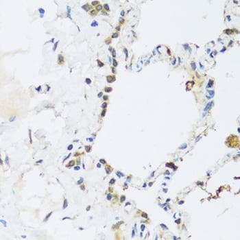 ATP2A3 / SERCA3 Antibody