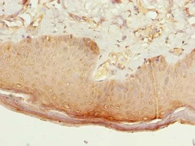 CMTR2 / FTSJD1 Antibody