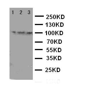 Polyclonal Rabbit anti-Human TRPC6 Antibody (aa249-265, IHC, WB)