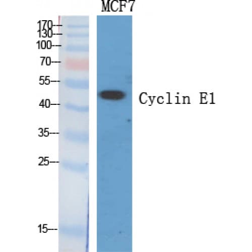 CCNE1 / Cyclin E1 Antibody (60-140 aa, Internal)