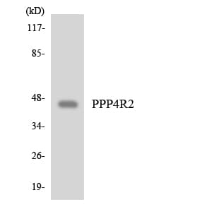 PPP4R2 Antibody (aa163-212)