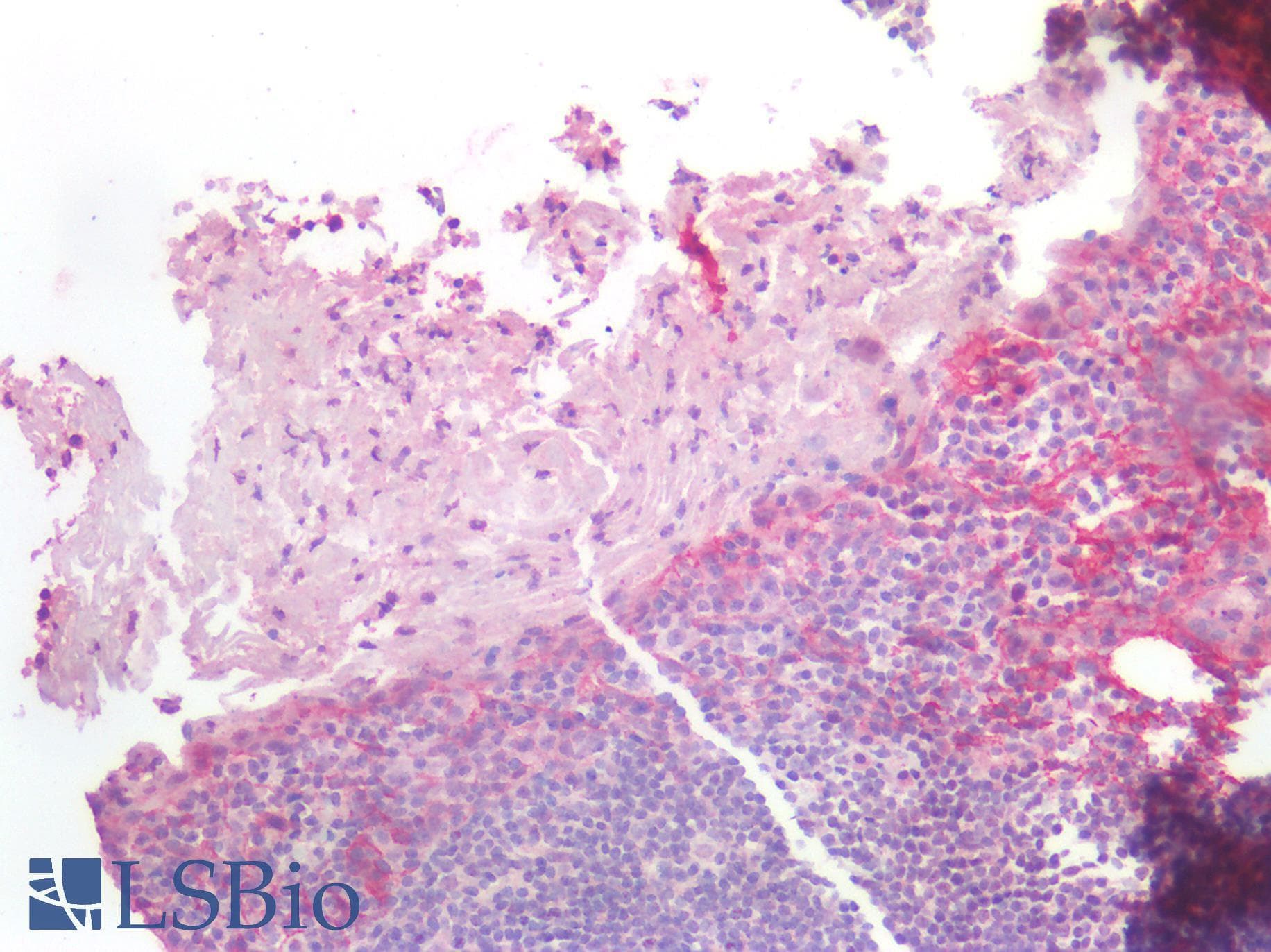 PathPlus™ CTNNB1 / Beta Catenin Antibody